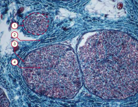 2004-2005 B. Schwaller, Departementde Médecine, Division d'Histologie de l'Université de Fribourg , Pérolles, CH-1705 Fribourg, Suisse